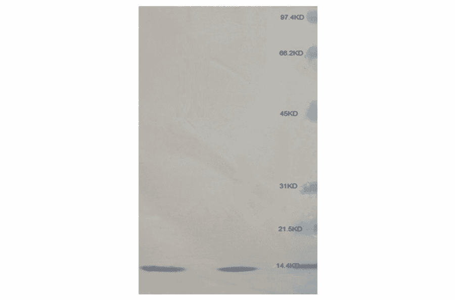 Western Blot - Anti-beta 2 Microglobulin Antibody (MO-M40021C) - Antibodies.com