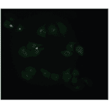 Immunofluorescence - Anti-beta 2 Microglobulin Antibody (MO-M40021C) - Antibodies.com