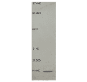 Western Blot - Anti-beta 2 Microglobulin Antibody (MO-M40021E) - Antibodies.com