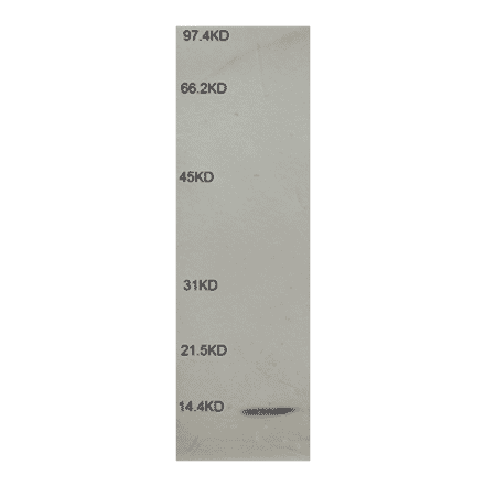 Western Blot - Anti-beta 2 Microglobulin Antibody (MO-M40021E) - Antibodies.com