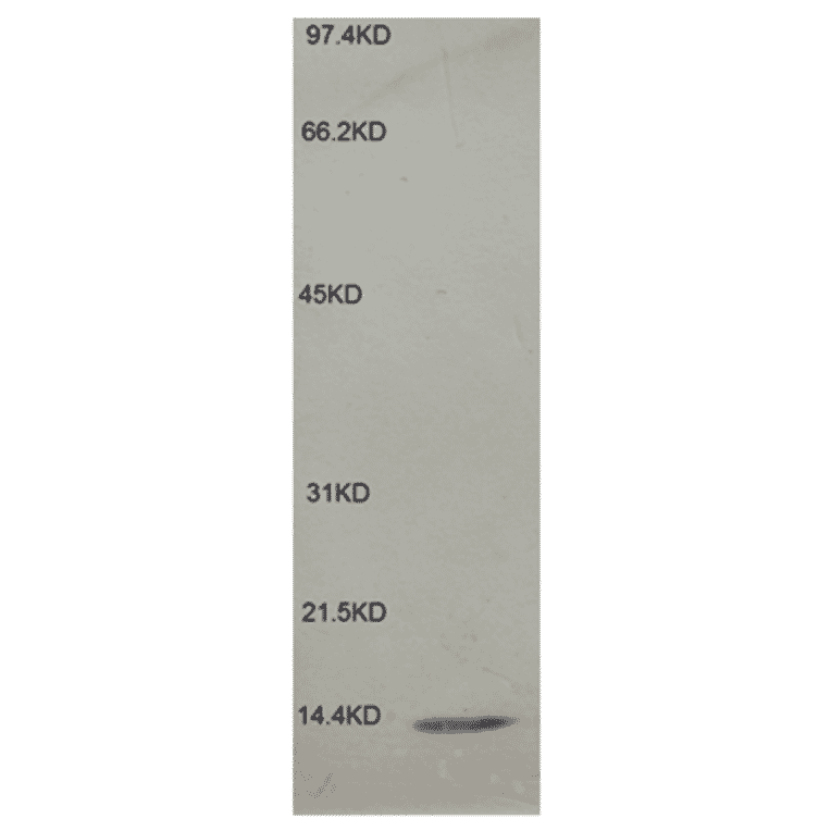 Western Blot - Anti-beta 2 Microglobulin Antibody (MO-M40021E) - Antibodies.com