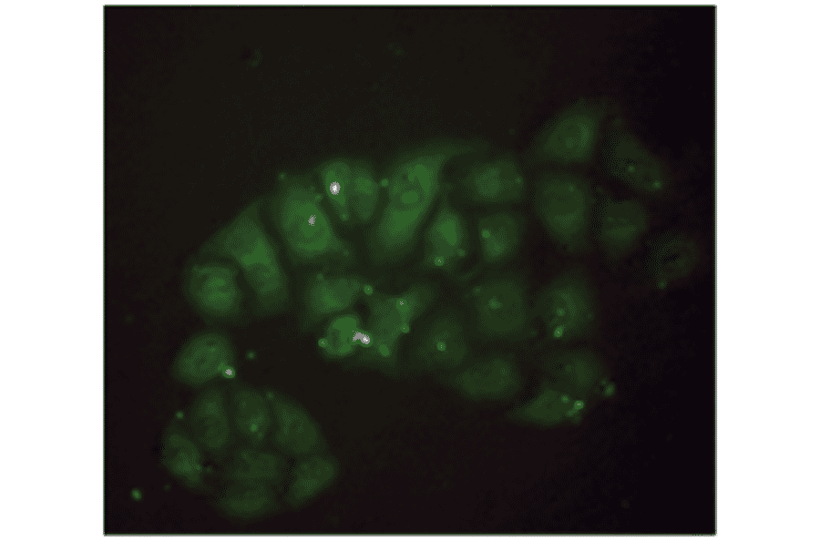 Immunofluorescence - Anti-beta 2 Microglobulin Antibody (MO-M40021E) - Antibodies.com