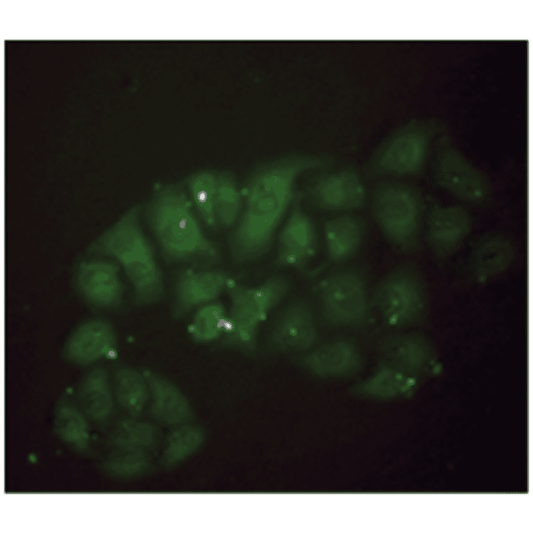 Immunofluorescence - Anti-beta 2 Microglobulin Antibody (MO-M40021E) - Antibodies.com