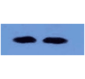 Western Blot - Anti-beta 2 Microglobulin Antibody (MO-M40021F) - Antibodies.com