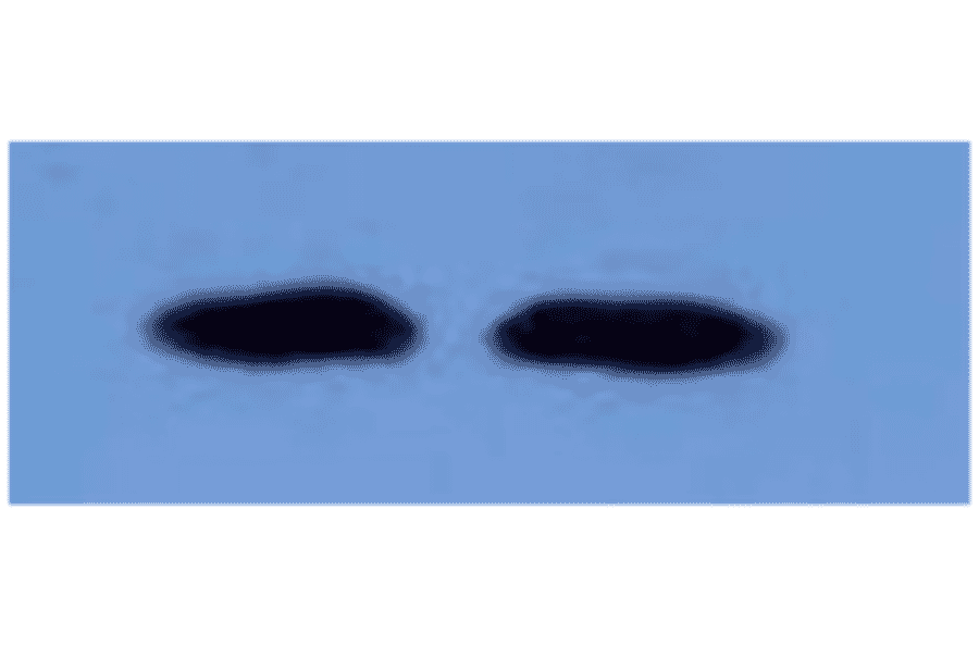 Western Blot - Anti-beta 2 Microglobulin Antibody (MO-M40021F) - Antibodies.com