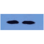 Western Blot - Anti-beta 2 Microglobulin Antibody (MO-M40021F) - Antibodies.com