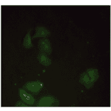 Immunofluorescence - Anti-beta 2 Microglobulin Antibody (MO-M40021F) - Antibodies.com