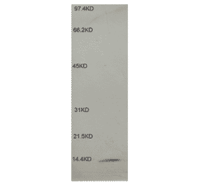 Western Blot - Anti-beta 2 Microglobulin Antibody (MO-M40021B) - Antibodies.com