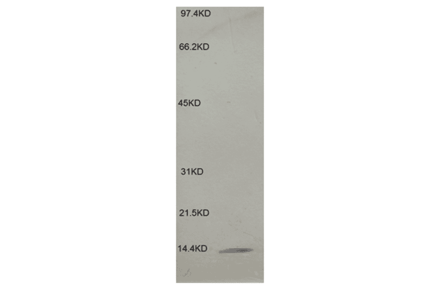 Western Blot - Anti-beta 2 Microglobulin Antibody (MO-M40021B) - Antibodies.com