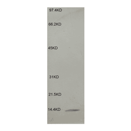 Western Blot - Anti-beta 2 Microglobulin Antibody (MO-M40021B) - Antibodies.com