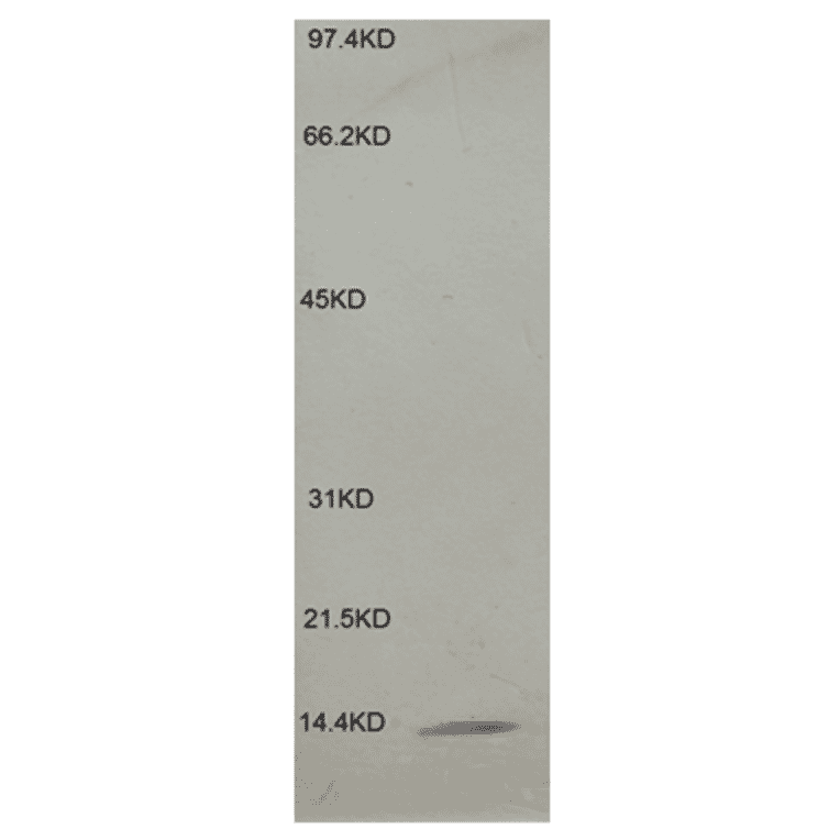 Western Blot - Anti-beta 2 Microglobulin Antibody (MO-M40021B) - Antibodies.com