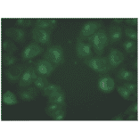 Immunofluorescence - Anti-beta 2 Microglobulin Antibody (MO-M40021B) - Antibodies.com
