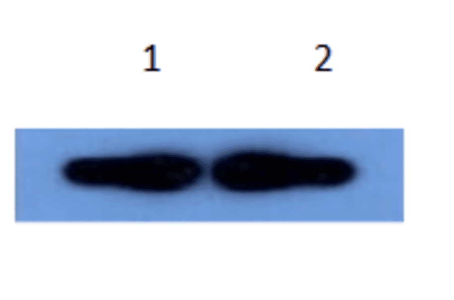 Western Blot - Anti-alpha 1 Antichymotrypsin Antibody (MO-M40096A) - Antibodies.com