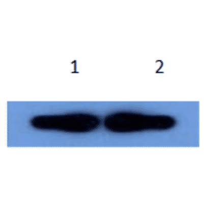Western Blot - Anti-alpha 1 Antichymotrypsin Antibody (MO-M40096A) - Antibodies.com