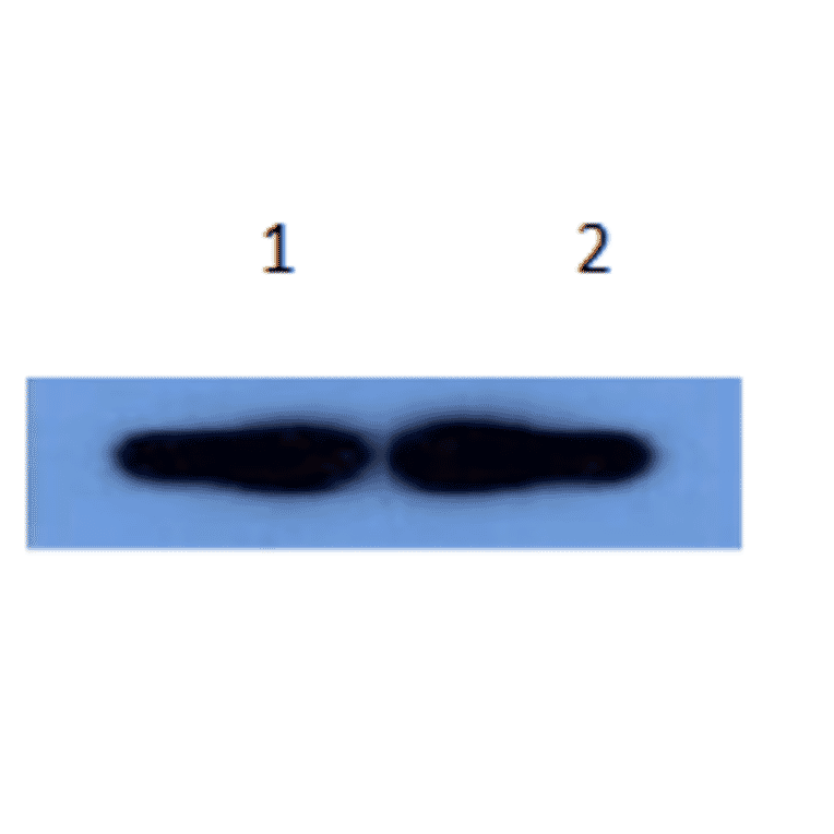 Western Blot - Anti-alpha 1 Antichymotrypsin Antibody (MO-M40096A) - Antibodies.com