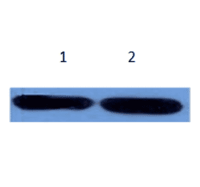 Western Blot - Anti-alpha 1 Antichymotrypsin Antibody (MO-M40096B) - Antibodies.com