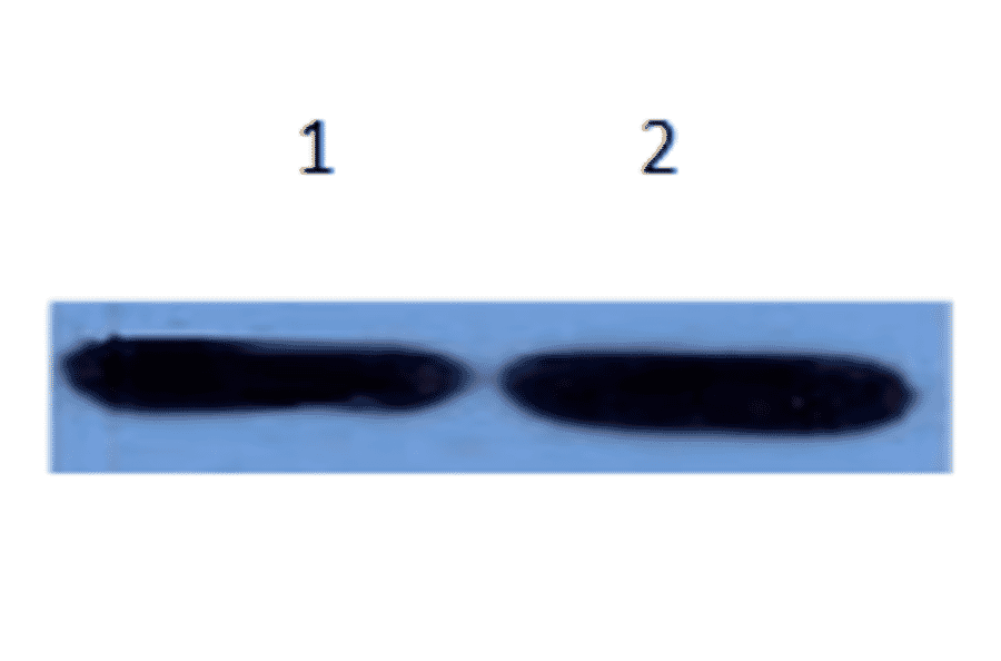 Western Blot - Anti-alpha 1 Antichymotrypsin Antibody (MO-M40096B) - Antibodies.com
