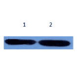 Western Blot - Anti-alpha 1 Antichymotrypsin Antibody (MO-M40096B) - Antibodies.com