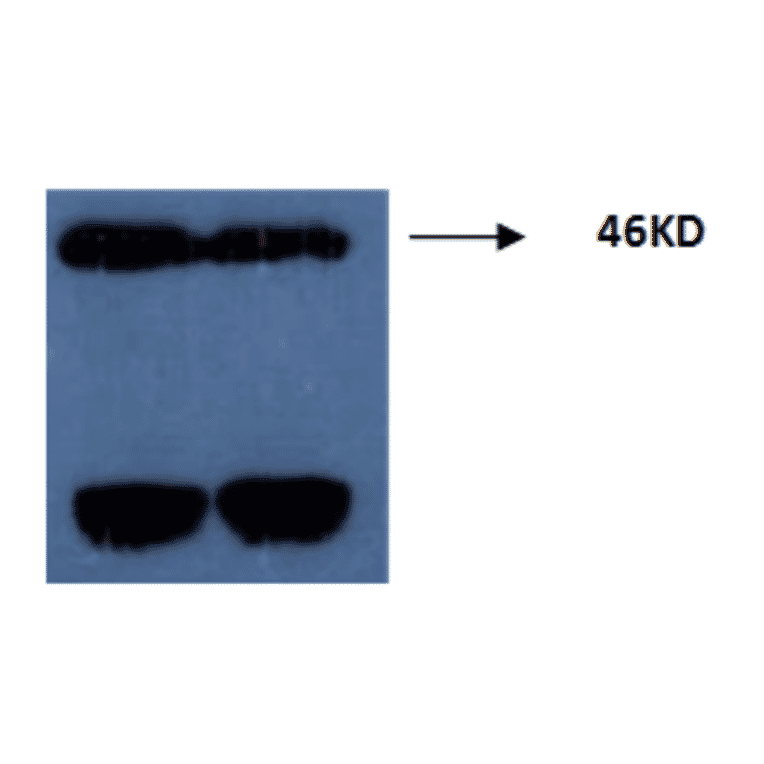 Western Blot - Anti-Tau (phospho Thr181) Antibody (MO-M40099C) - Antibodies.com