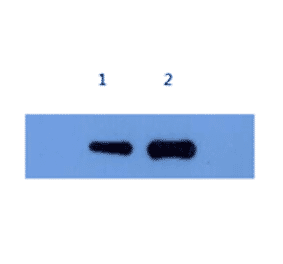Western Blot - Anti-Alpha-Synuclein Antibody (MO-M40097C) - Antibodies.com