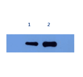 Western Blot - Anti-Alpha-Synuclein Antibody (MO-M40097D) - Antibodies.com