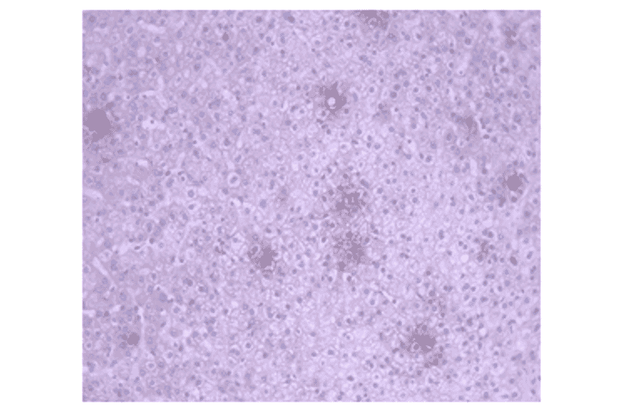 Immunohistochemistry - Anti-CA 125 Antibody (MO-T40012B) - Antibodies.com