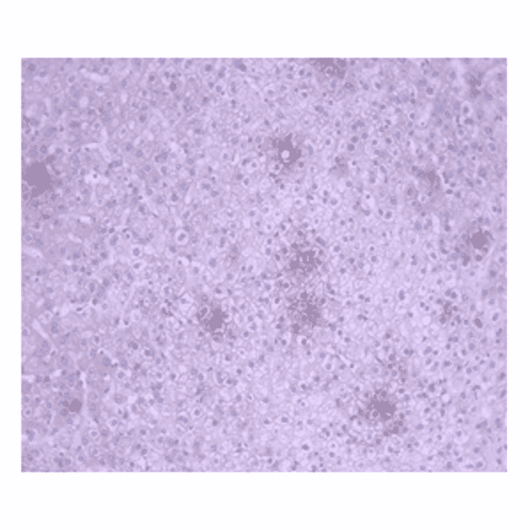 Immunohistochemistry - Anti-CA 125 Antibody (MO-T40012B) - Antibodies.com