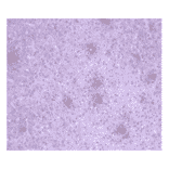 Immunohistochemistry - Anti-CA 125 Antibody (MO-T40012B) - Antibodies.com