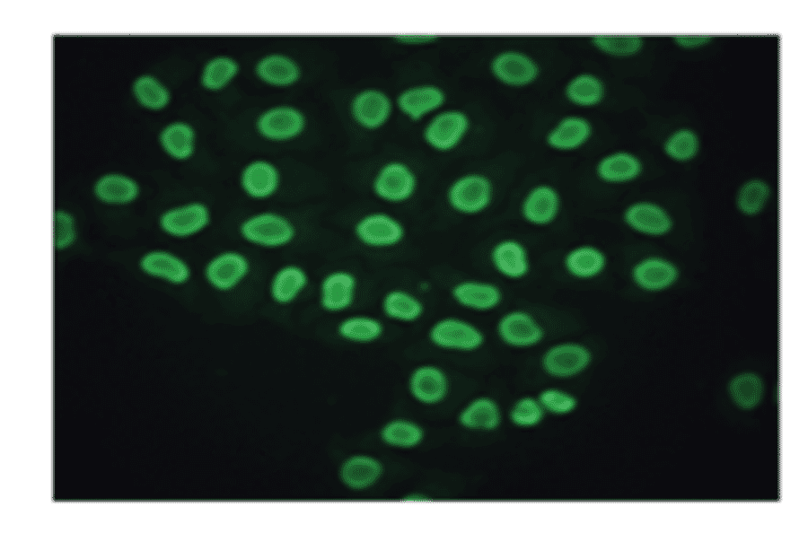 Immunofluorescence - Anti-CA 125 Antibody (MO-T40012B) - Antibodies.com