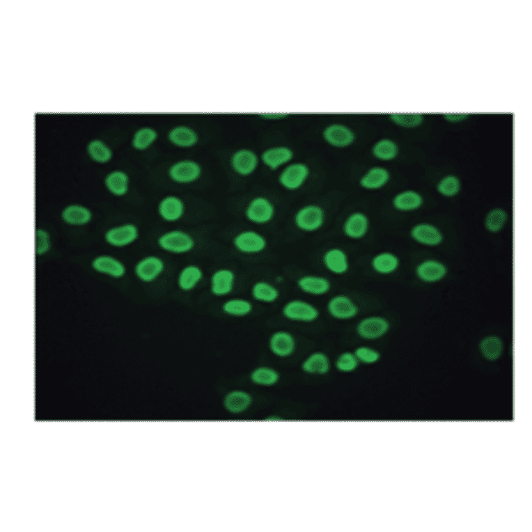 Immunofluorescence - Anti-CA 125 Antibody (MO-T40012B) - Antibodies.com