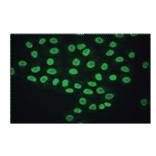 Immunofluorescence - Anti-CA 125 Antibody (MO-T40012B) - Antibodies.com