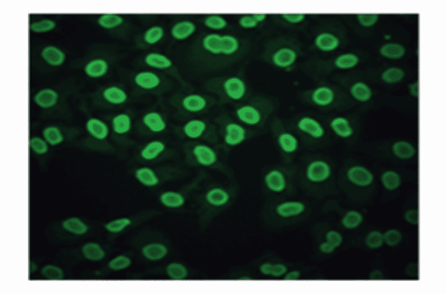 Immunofluorescence - Anti-CA 125 Antibody (MO-T40012C) - Antibodies.com