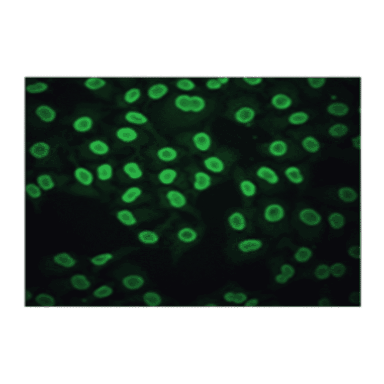 Immunofluorescence - Anti-CA 125 Antibody (MO-T40012C) - Antibodies.com