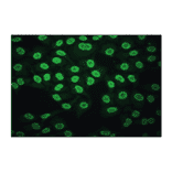 Immunofluorescence - Anti-CA 125 Antibody (MO-T40012C) - Antibodies.com