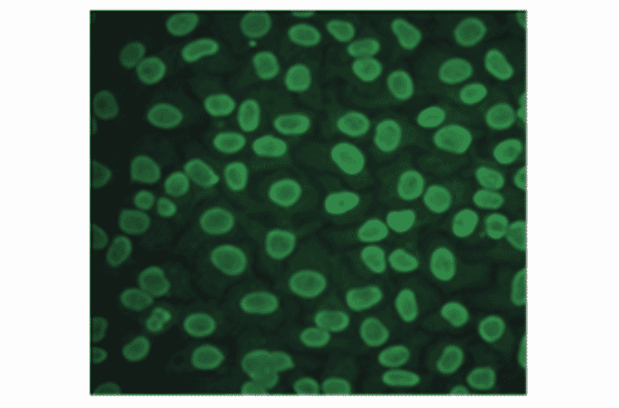 Immunofluorescence - Anti-CA 125 Antibody (MO-T40012D) - Antibodies.com