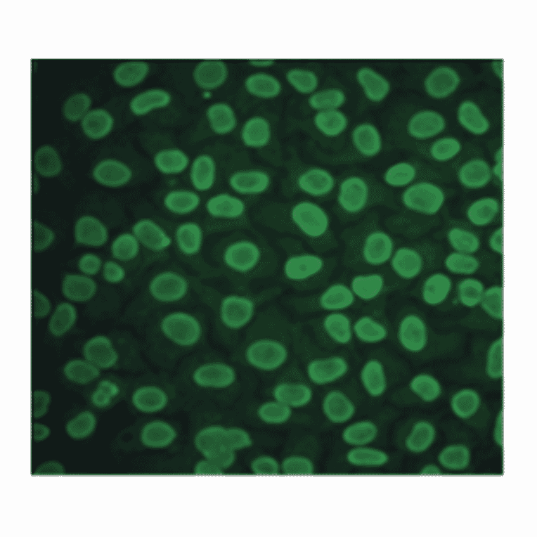 Immunofluorescence - Anti-CA 125 Antibody (MO-T40012D) - Antibodies.com