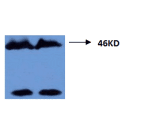 Western Blot - Anti-Tau (phospho Thr181) Antibody (MO-M40099A) - Antibodies.com