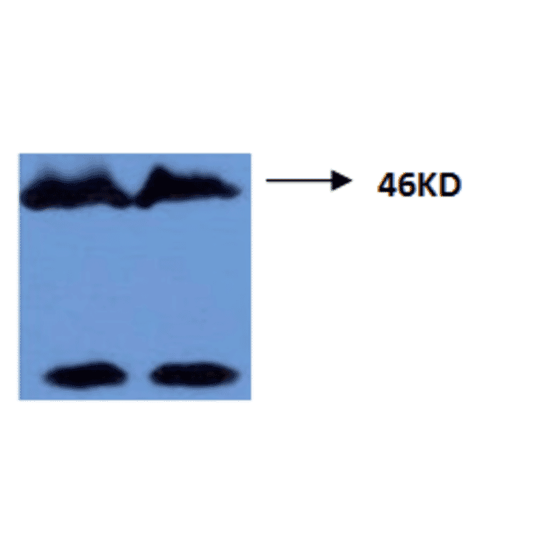 Western Blot - Anti-Tau (phospho Thr181) Antibody (MO-M40099A) - Antibodies.com