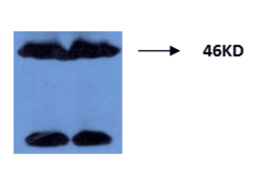 Western Blot - Anti-Tau (phospho Thr181) Antibody (MO-M40099B ) - Antibodies.com