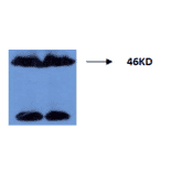 Western Blot - Anti-Tau (phospho Thr181) Antibody (MO-M40099B ) - Antibodies.com