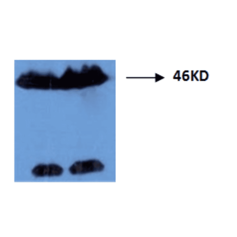 Western Blot - Anti-Tau (phospho Thr181) Antibody (MO-M40099D) - Antibodies.com