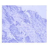 Immunohistochemistry - Anti-Lung Carcinoma Antibody (MO-T40005C) - Antibodies.com