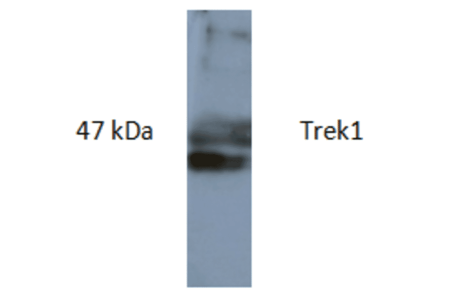 Western Blot - Anti-TREK1 Antibody (AI80006A) - Antibodies.com