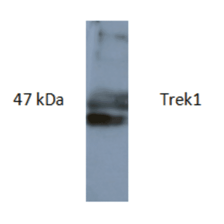 Western Blot - Anti-TREK1 Antibody (AI80006A) - Antibodies.com