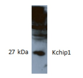 Western Blot - Anti-KCHIP1 Antibody (AI80007) - Antibodies.com