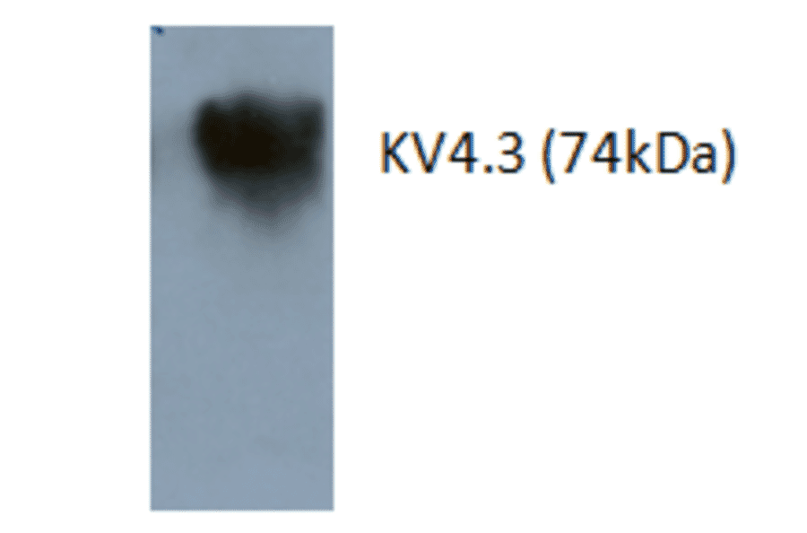 Western Blot - Anti-Kv4.3 Antibody (AI80010A) - Antibodies.com