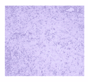 Immunohistochemistry - Anti-JAK2 Antibody (AI80013A) - Antibodies.com