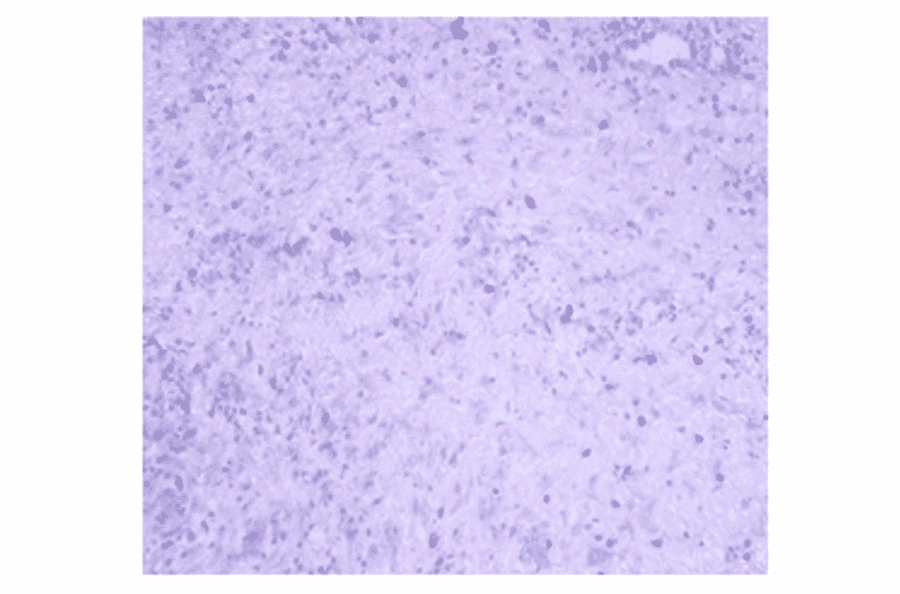 Immunohistochemistry - Anti-JAK2 Antibody (AI80013A) - Antibodies.com