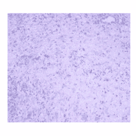 Immunohistochemistry - Anti-JAK2 Antibody (AI80013A) - Antibodies.com
