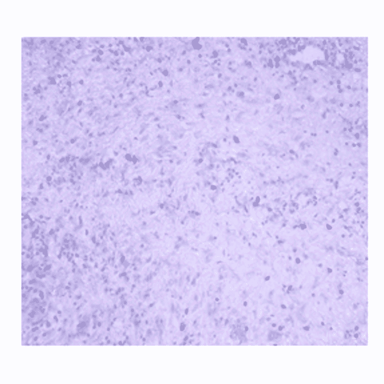 Immunohistochemistry - Anti-JAK2 Antibody (AI80013A) - Antibodies.com